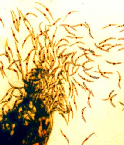 Experimental malaria vaccine shows promise in Phase I trials.