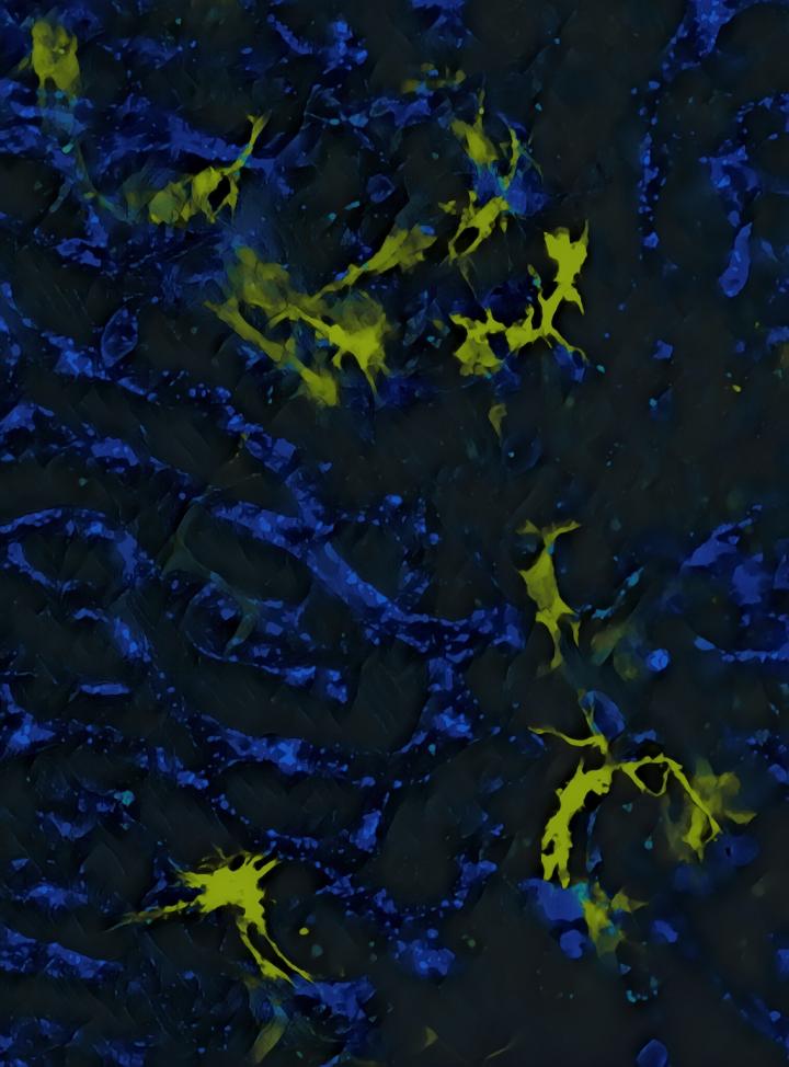 Scientists working to make immunotherapy less toxic.