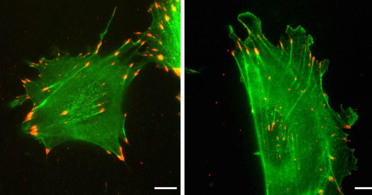 Nucleotides account for subtle differences between forms of actin.