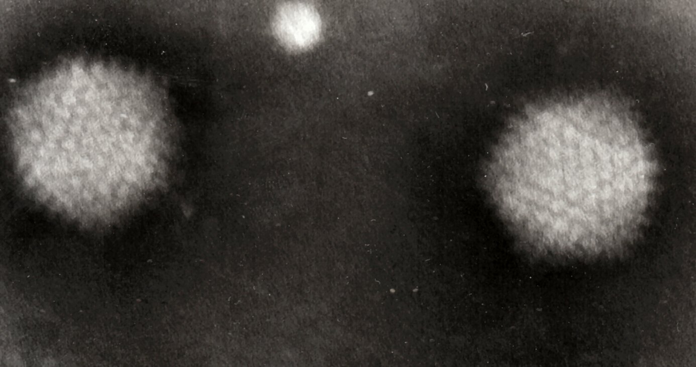 CRISPR-Cas9 delivered by adenovirus may revolutionize gene therapy.