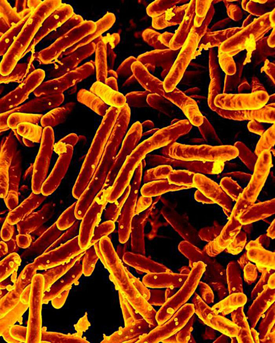 Researchers take a different route towards a TB vaccine.