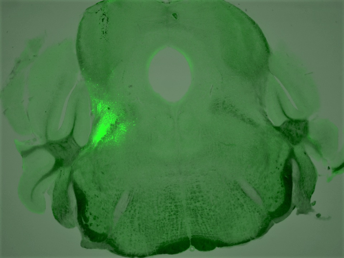 Receptors involved in opioid deaths identified.
