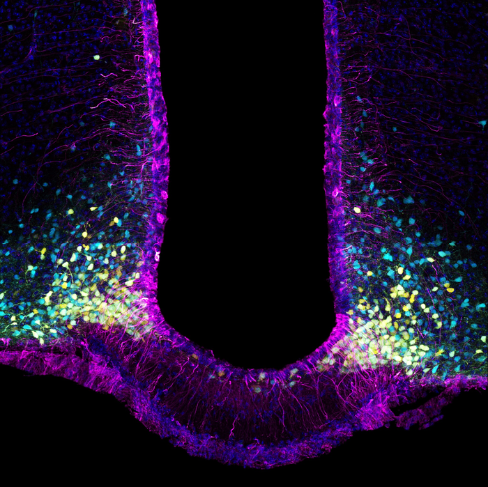Study of satiety mechanism in diabetes yields new knowledge