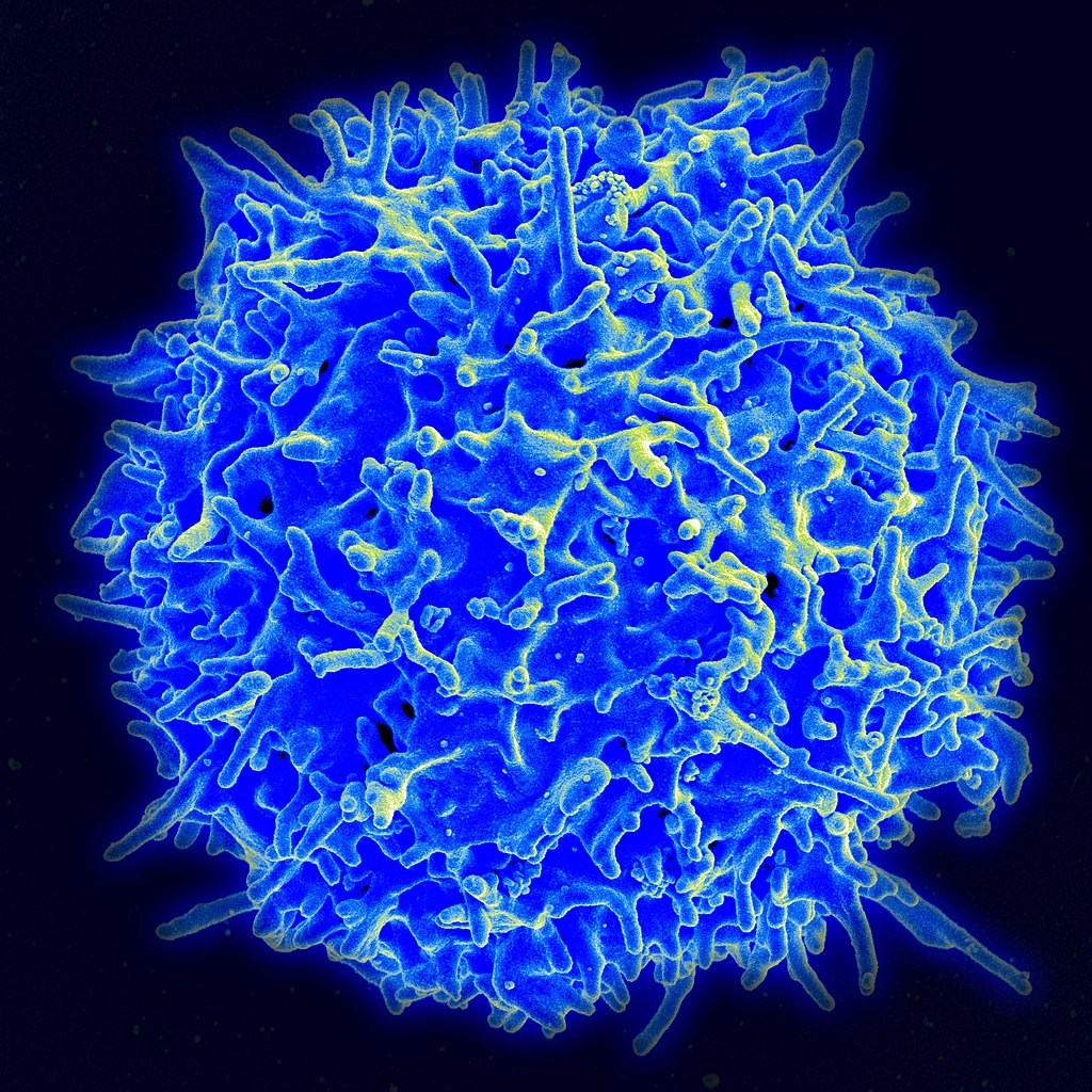 Impaired T-cell function precedes loss of natural HIV control.