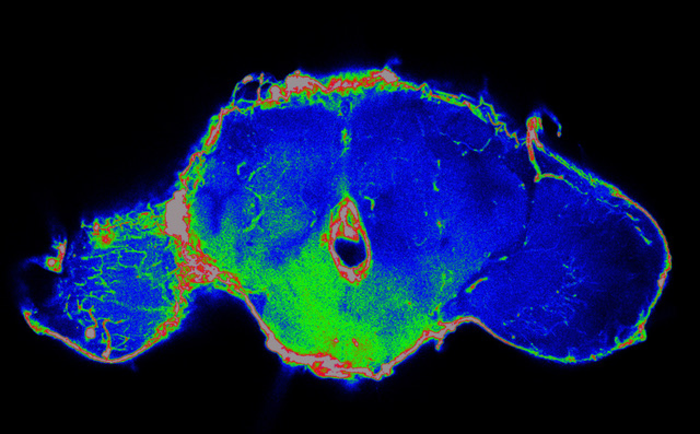 New anti-cancer strategy is based on fruit fly biology.