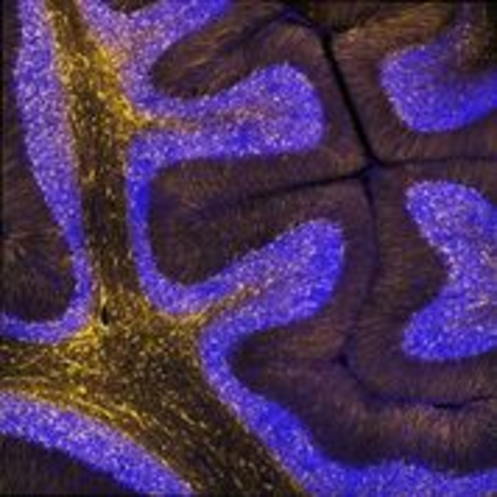Many of our fastest evolving genes are linked with brain development.