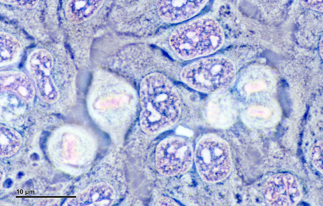 DAILY DOSE: Henrietta Lacks honored with a statue then her family sues Thermo Fisher.