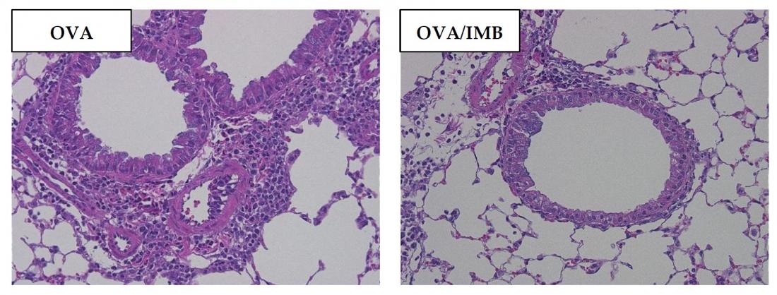 Fermented soybeans suppress asthma-induced airway inflammation.