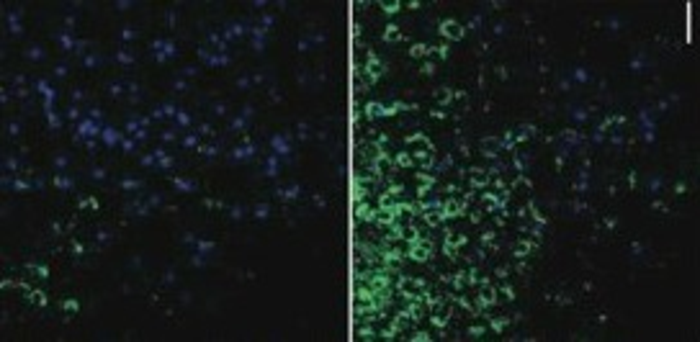 New research finds air pollution reduces sperm counts through brain inflammation.