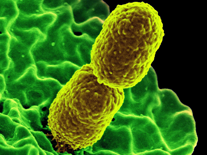 Scientists identify evolutionary gateway helping pneumonia bacteria become resistant to antibiotics