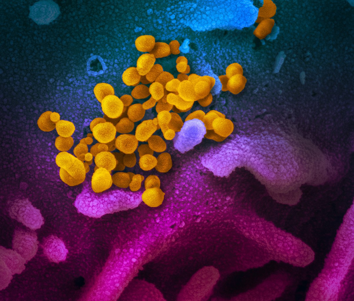 First real-world study reports effectiveness of BBV152 against symptomatic COVID-19 in India.