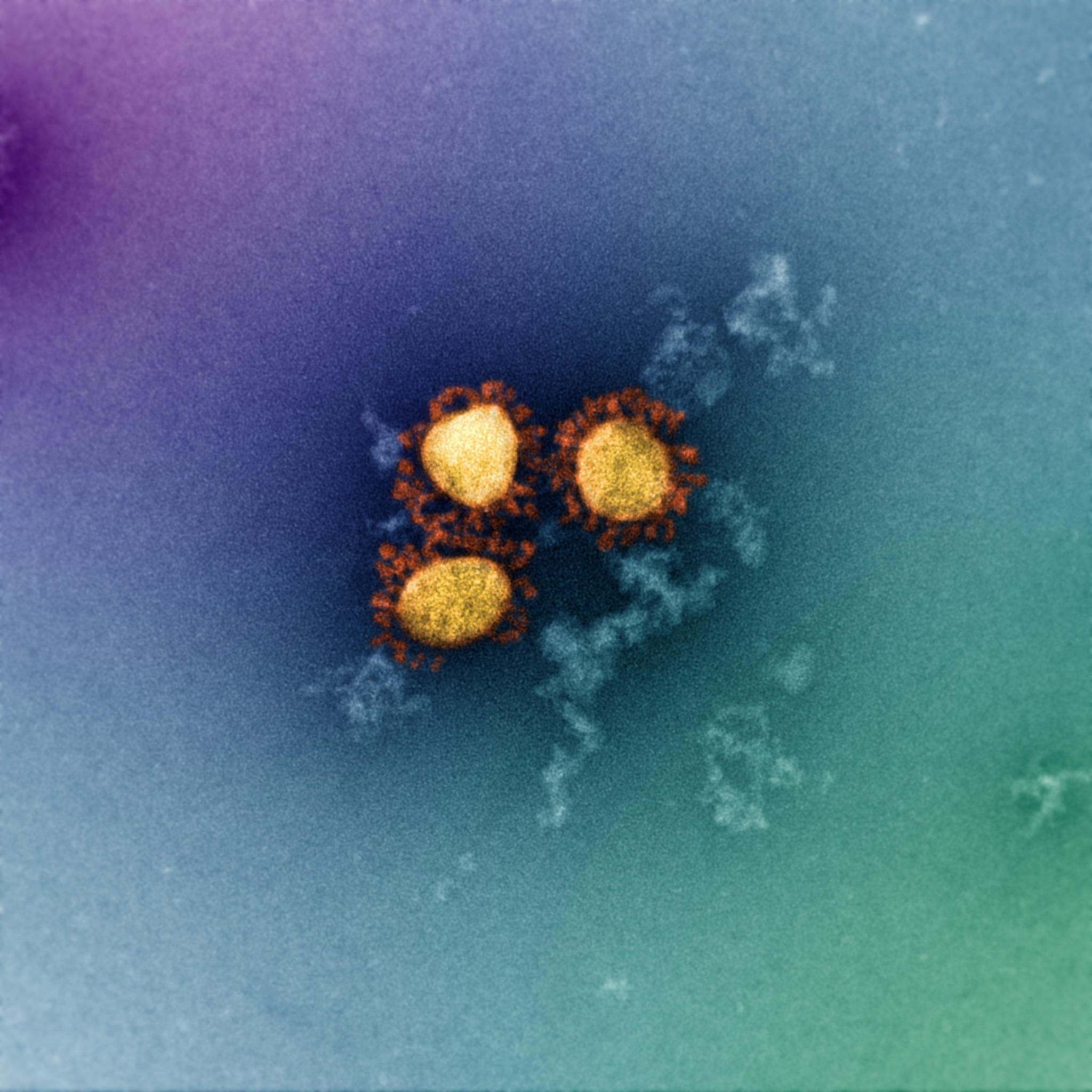 Early UK data suggests hospitalisation risk is lower for Omicron than for Delta