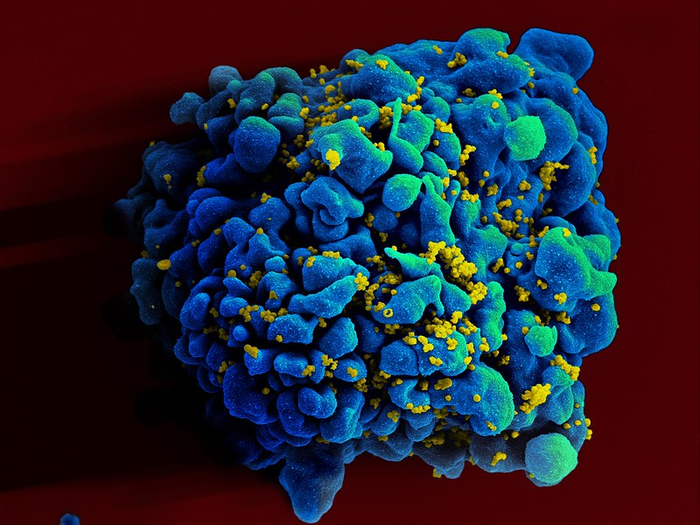 Experimental mRNA HIV vaccine safe, shows promise in animals.