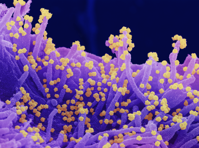 Hyperimmune intravenous immunoglobulin does not improve outcomes for adults hospitalized with COVID-19