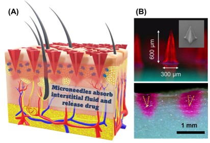 Rethinking How Drugs are Administered: A Breakthrough in Microneedle Patches.