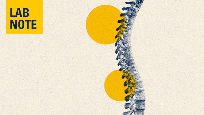 Mental health is an issue for people with spinal cord injury. Chronic pain makes it worse.