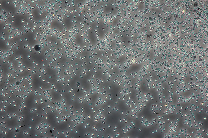 Climate change and extreme weather will have complex effects on disease transmission