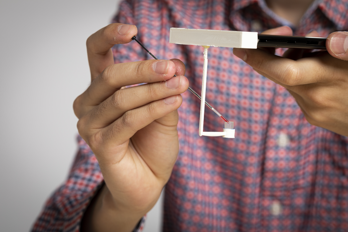 Smartphone app can vibrate a single drop of blood to determine how well it clots.