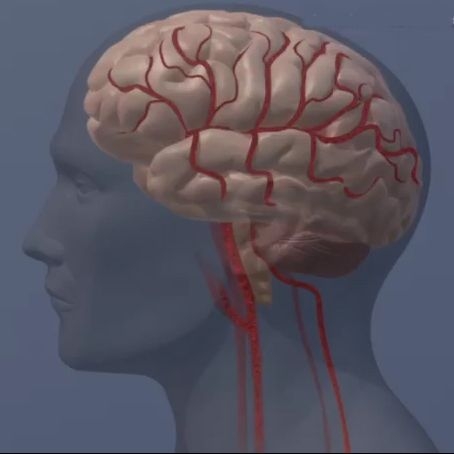 People with serious mental illness may have increased heart disease risk at younger ages.