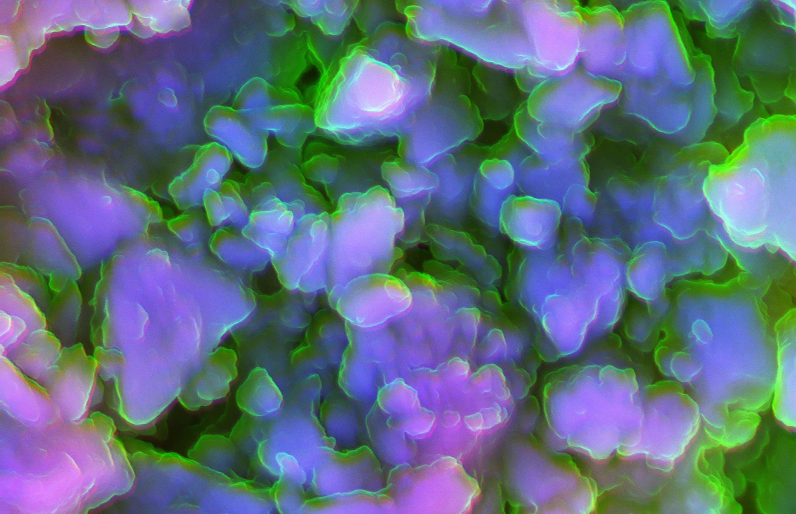 Using sound waves to break up kidney stones.