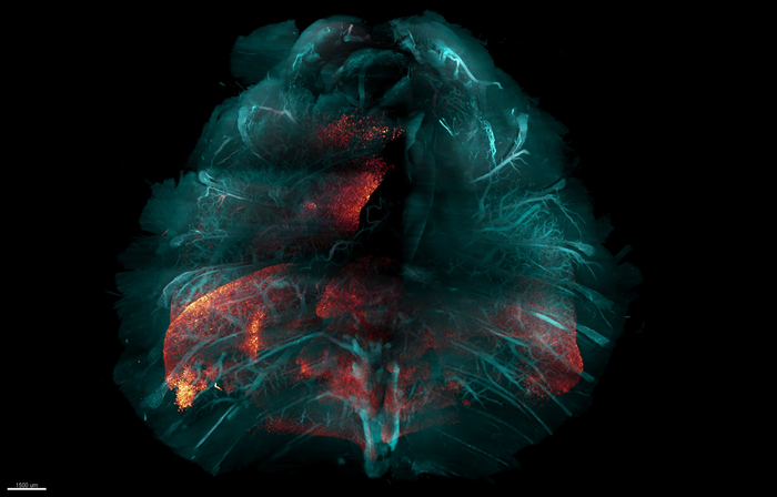 New method for making tissue transparent could speed the study of many diseases.