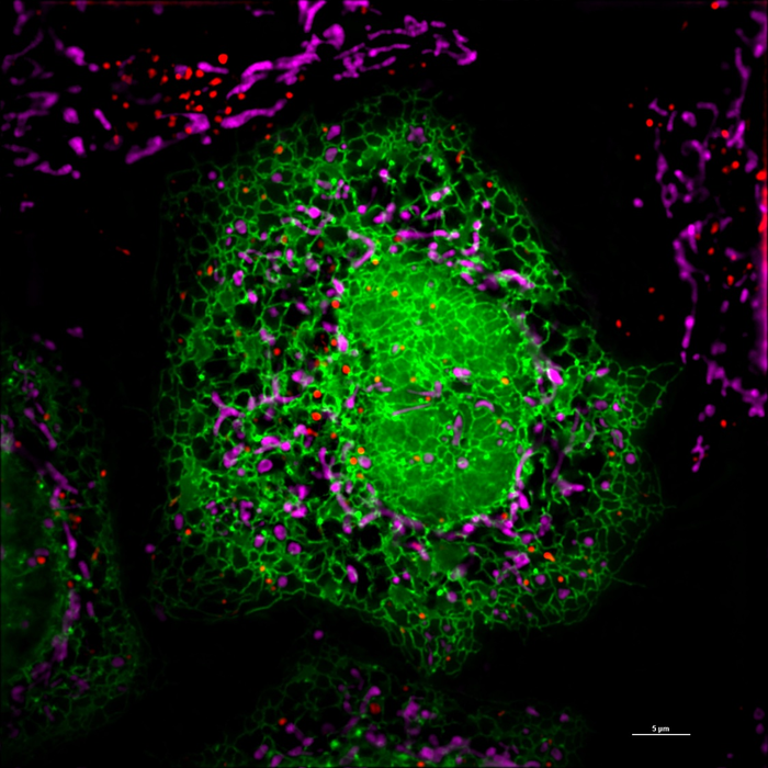 Advancing our view at the subcellular level