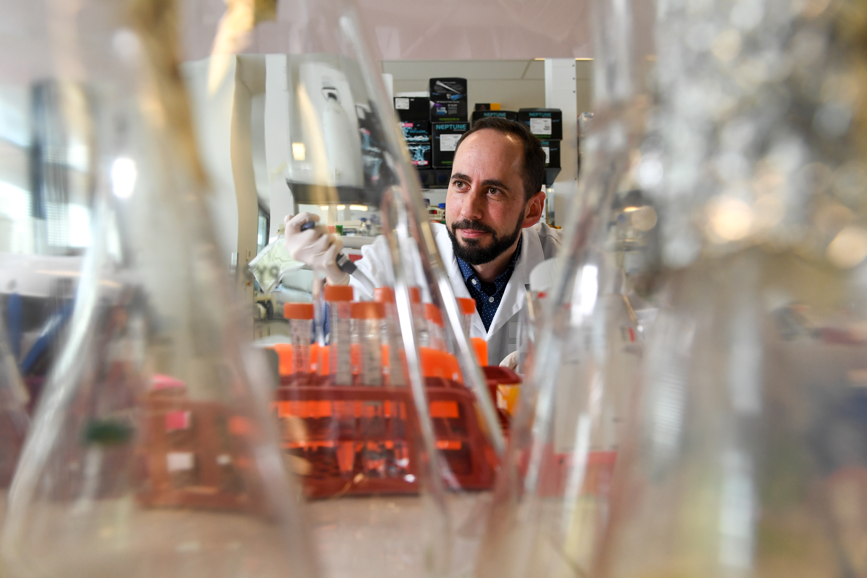 Finding the genetic cause of lupus.