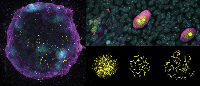 Turning X chromosome “off and on again” critical for oocyte development.
