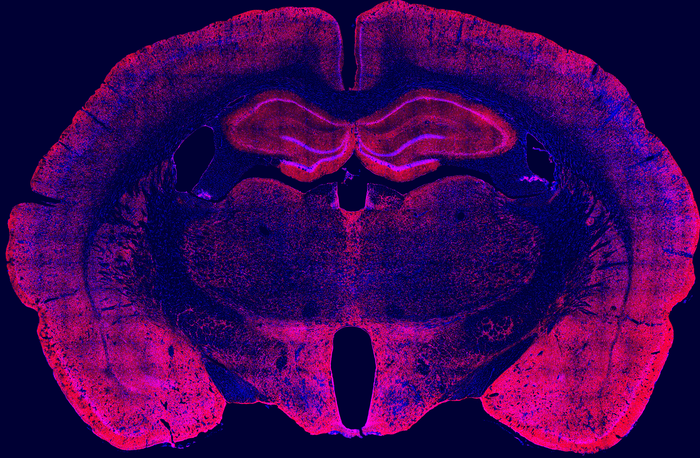 Scripps Research study reveals how alcohol cravings get stronger after drinking during withdrawal.