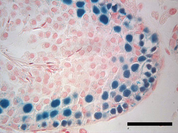 Frozen testicular tissue still viable after two decades.