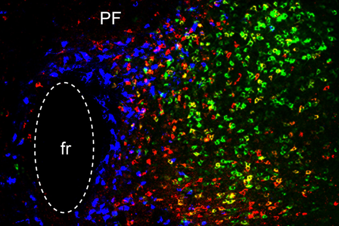 Three distinct brain circuits in the thalamus contribute to Parkinson’s symptoms.