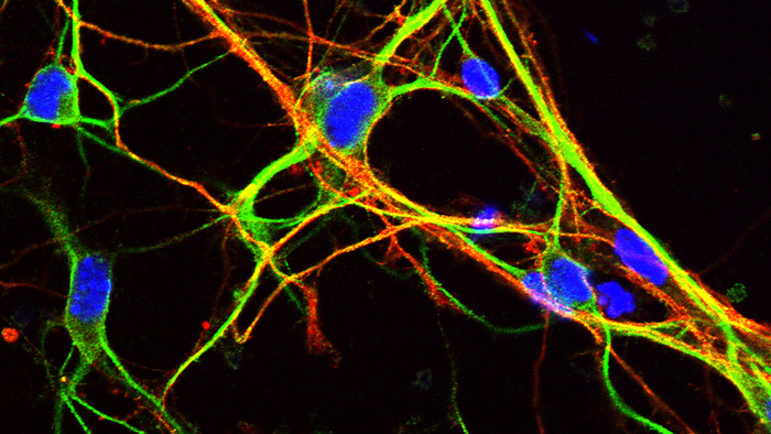 Scientists unravel the mystery of genes that are key to brain development.