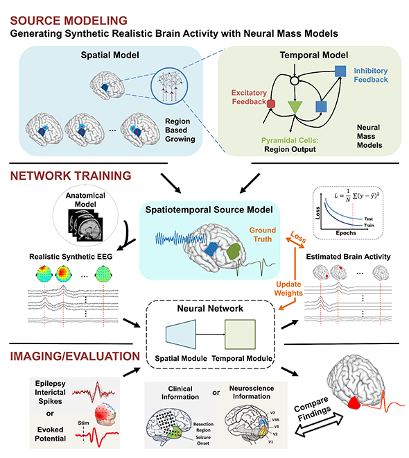 Advancing dynamic brain imaging with AI.