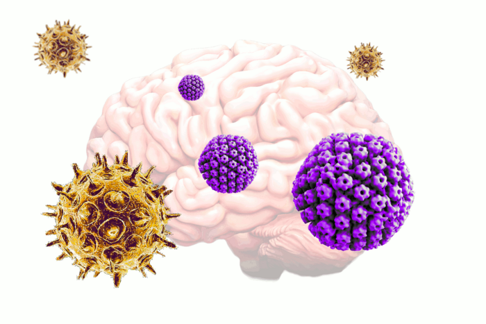 Common viruses may be triggering the onset of Alzheimer’s disease.
