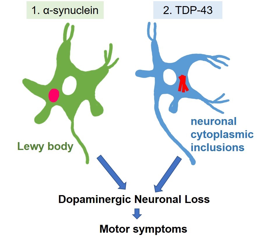 A new cause of Parkinson’s disease-related cell death.