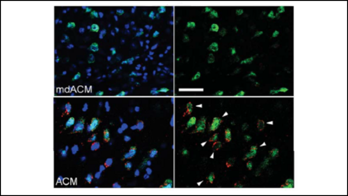 Brain support cells transfer their mitochondria to fight free radicals