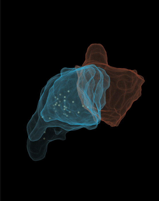 T cells use force to destroy cancer cells