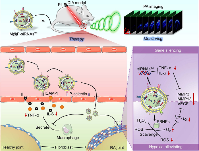 New strategy enables targeted treatment of rheumatoid arthritis.