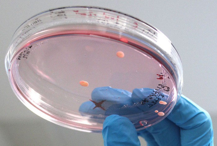 Brain-like organoids grown in a dish provide window into autism