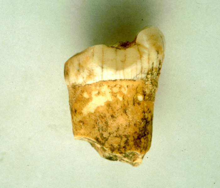 Neanderthals appear to have been carnivores.