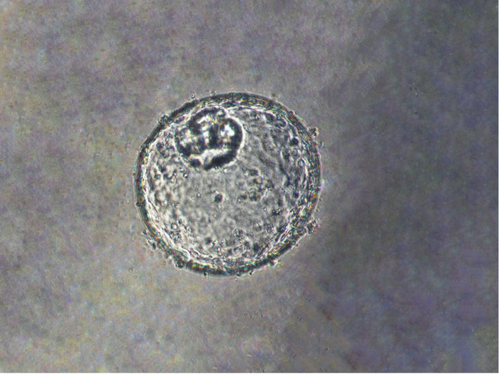 Johns Hopkins researchers generate lab-grown human tissue model for food tube cancer