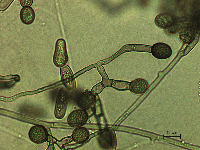 Two fungi work together to kill fig trees