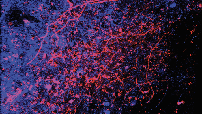 Origins of pleasurable touch traced from skin to brain in mice
