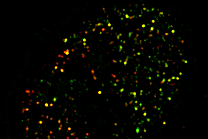 Study reveals obesity-related trigger that can lead to diabetes