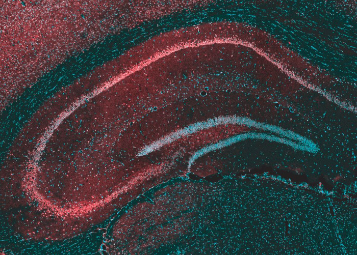 Study reveals how CBD counters epileptic seizures