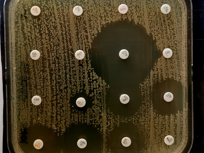 Emergence of extensively drug-resistant Shigella sonnei strain in France