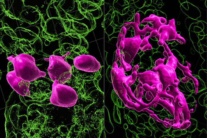 Study links “stuck” stem cells to hair turning gray