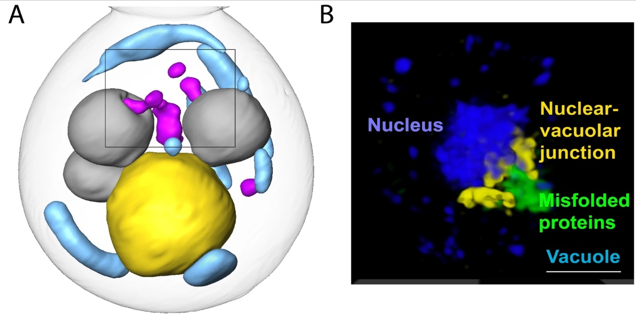 Study finds new pathway for clearing misfolded proteins