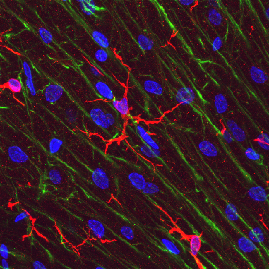 New Study Reveals How the Immune System Shapes the Developing Brain in a Sex-Specific Manner.
