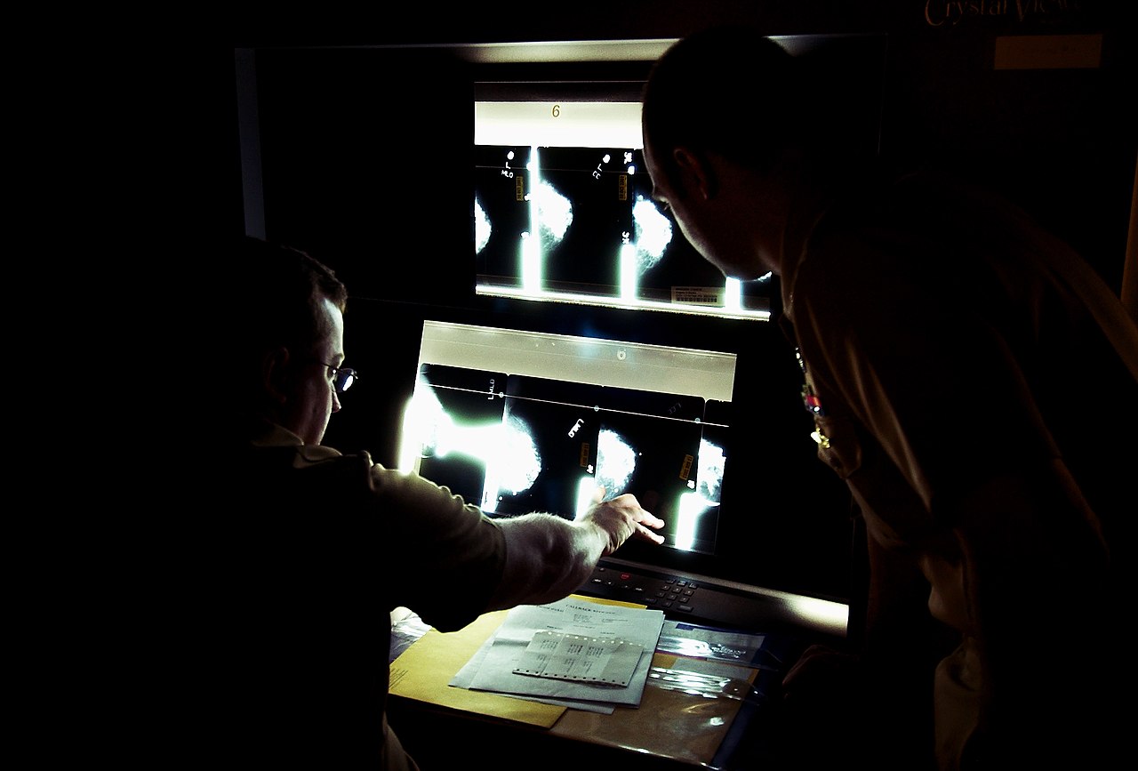 Revised Mammogram Guidelines: Health Experts Recommend Screenings Begin at Age 40.